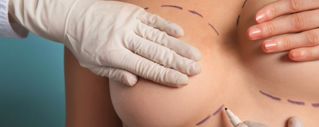 Cirurgia de Redução de Mama: Benefícios Além da Estética