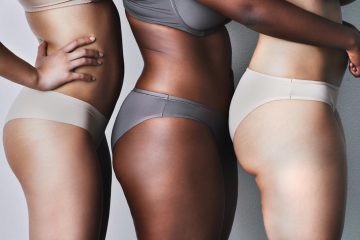 Dia do Combate à Celulite reforça que o problema vai além da estética e afeta a saúde e autoestima de milhões de mulheres