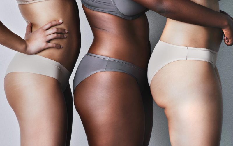 Dia do Combate à Celulite reforça que o problema vai além da estética e afeta a saúde e autoestima de milhões de mulheres