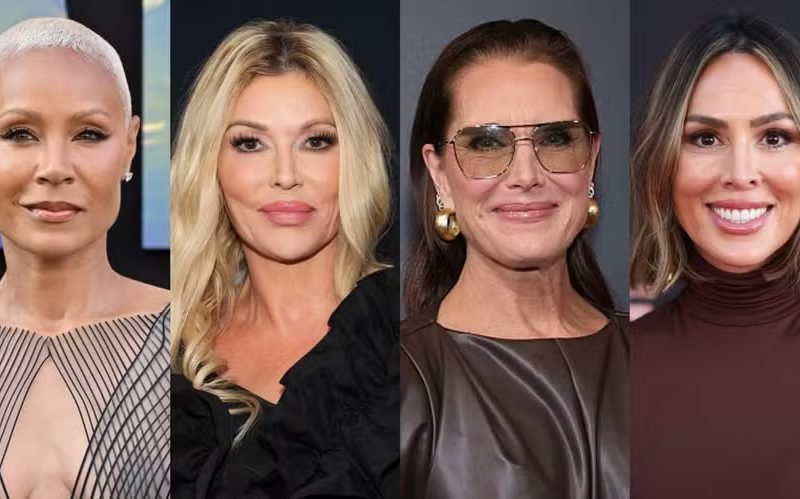 Divórcio, autoestima e autocuidado: os motivos que levaram famosas a recorrer à harmonização íntima